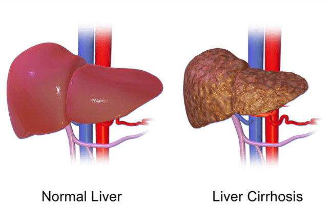 best-liver-specialist-doctor-list-in-dhaka-find-doctor-24